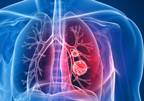 What part of the lungs does mesothelioma affect?