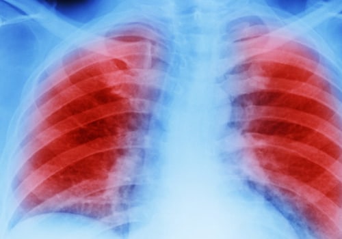 When do mesothelioma symptoms start?